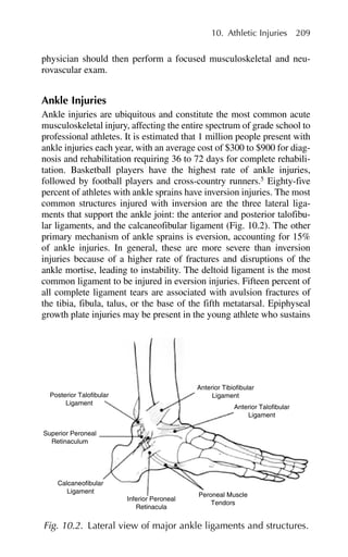 physician should then perform a focused musculoskeletal and neu-
rovascular exam.
Ankle Injuries
Ankle injuries are ubiquitous and constitute the most common acute
musculoskeletal injury, affecting the entire spectrum of grade school to
professional athletes. It is estimated that 1 million people present with
ankle injuries each year, with an average cost of $300 to $900 for diag-
nosis and rehabilitation requiring 36 to 72 days for complete rehabili-
tation. Basketball players have the highest rate of ankle injuries,
followed by football players and cross-country runners.5
Eighty-five
percent of athletes with ankle sprains have inversion injuries. The most
common structures injured with inversion are the three lateral liga-
ments that support the ankle joint: the anterior and posterior talofibu-
lar ligaments, and the calcaneofibular ligament (Fig. 10.2). The other
primary mechanism of ankle sprains is eversion, accounting for 15%
of ankle injuries. In general, these are more severe than inversion
injuries because of a higher rate of fractures and disruptions of the
ankle mortise, leading to instability. The deltoid ligament is the most
common ligament to be injured in eversion injuries. Fifteen percent of
all complete ligament tears are associated with avulsion fractures of
the tibia, fibula, talus, or the base of the fifth metatarsal. Epiphyseal
growth plate injuries may be present in the young athlete who sustains
10. Athletic Injuries 209
Peroneal Muscle
Tendors
Inferior Peroneal
Retinacula
Calcaneofibular
Ligament
Posterior Talofibular
Ligament
Anterior Tibiofibular
Ligament
Anterior Talofibular
Ligament
Superior Peroneal
Retinaculum
Fig. 10.2. Lateral view of major ankle ligaments and structures.
 