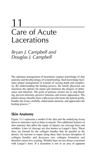 11
Care of Acute
Lacerations
Bryan J. Campbell and
Douglas J. Campbell
The optimum management of lacerations requires knowledge of skin
anatomy and the physiology of wound healing. Such knowledge facil-
itates proper management of wounds of varying depth and complex-
ity. By understanding the healing process, the family physician can
maximize the options for repair and minimize the dangers of dehis-
cence and infection. The goals of primary closure are to stop bleed-
ing, prevent infection, preserve function, and restore appearance. The
patient always benefits from a physician who treats the patient gently,
handles the tissue carefully, understands anatomy, and appreciates the
healing process.1,2
Skin Anatomy
Figure 11.1 represents a model of the skin and the underlying tissue
down to structures such as bone or muscle. Two additional features of
skin anatomy that affect the repair of injuries are cleavage lines and
wrinkles. Lines of cleavage are also known as Langer’s lines. These
lines are formed by the collagen bundles that lie parallel in the
dermis. An incision or repair along these lines lessens disruption of
collagen bundles and decreases new collagen formation and
therefore causes less scarring. Wrinkle lines are not always consistent
with Langer’s lines. If a laceration is not in an area of apparent
 