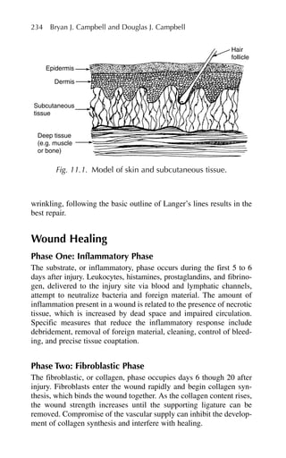 wrinkling, following the basic outline of Langer’s lines results in the
best repair.
Wound Healing
Phase One: Inflammatory Phase
The substrate, or inflammatory, phase occurs during the first 5 to 6
days after injury. Leukocytes, histamines, prostaglandins, and fibrino-
gen, delivered to the injury site via blood and lymphatic channels,
attempt to neutralize bacteria and foreign material. The amount of
inflammation present in a wound is related to the presence of necrotic
tissue, which is increased by dead space and impaired circulation.
Specific measures that reduce the inflammatory response include
debridement, removal of foreign material, cleaning, control of bleed-
ing, and precise tissue coaptation.
Phase Two: Fibroblastic Phase
The fibroblastic, or collagen, phase occupies days 6 though 20 after
injury. Fibroblasts enter the wound rapidly and begin collagen syn-
thesis, which binds the wound together. As the collagen content rises,
the wound strength increases until the supporting ligature can be
removed. Compromise of the vascular supply can inhibit the develop-
ment of collagen synthesis and interfere with healing.
234 Bryan J. Campbell and Douglas J. Campbell
Epidermis
Dermis
Subcutaneous
tissue
Deep tissue
(e.g. muscle
or bone)
Hair
follicle
Fig. 11.1. Model of skin and subcutaneous tissue.
 