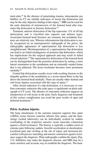 ment plan.16
In the absence of penetrating trauma, intracapsular gas
bubbles on CT are reliable indicators of recent hip dislocation and
may be the only objective finding of this injury.17
MRI can be used for
the early detection of osteonecrosis of the femoral head after trau-
matic hip dislocation or fracture dislocation.18
Traumatic anterior dislocation of the hip represents 11% of all hip
dislocations and is classified into superior and inferior types.
Associated femoral head fractures are common, but acetabular frac-
tures are relatively rare. Whereas inferoanterior hip dislocation is eas-
ily recognized on an anteroposterior radiograph of the pelvis, the
radiographic appearance of superoanterior hip dislocation is less
straightforward. Misinterpretation of a superoanterior hip dislocation
can lead to an initial misdiagnosis of posterior hip dislocation, which
has implications for the surgical approach and may result in failed
closed reduction.19
The superoanterior dislocation of the femoral head
can be distinguished from the posterior dislocation by noting a more
lateral orientation to the acetabulum and an externally rotated femur
that is not adducted. The lesser trochanter becomes more prominent
medially.20
Central hip dislocations usually occur with resulting fracture to the
iliopubic portion of the acetabulum as a severe lateral blow to the hip
drives the femoral head medially. There are usually other skeletal and
soft tissue injuries associated with this type of injury.14
After closed reduction of a hip dislocation, it is necessary to con-
firm concentric reduction (the joint space is equidistant on plain radi-
ograph or CT scan). The absence of concentric reduction suggests an
interposition of soft tissue in the joint. Early diagnosis and treatment
of this serious complication can avoid the poor results of open and
deferred treatments.21
Pelvic Avulsion Injuries
The bony attachments of the sartorius [anterior superior iliac spine
(ASIS)], rectus femoris (anterior inferior iliac spine), and the ham-
strings (ischial tuberosity) can be individually avulsed by sudden
overloading of the respective muscles (acute muscular contraction
against a fixed resistance). The history is typically a sudden onset of
extreme pain following sudden, forceful acceleration or deceleration.
Localized pain and swelling at the site of injury and increased dis-
comfort with passive stretching and muscle contraction against resist-
ance suggest the diagnosis. Plain radiographs confirm the injury (Fig.
3.3). Subtleties may make the diagnosis obscure, and MRI may be a
more sensitive and accurate way to establish the diagnosis. The ham-
64 Kenneth M. Bielak and Bradley E. Kocian
 