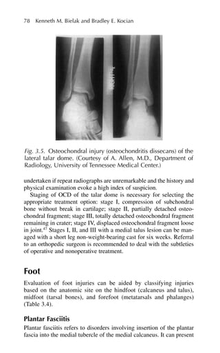 undertaken if repeat radiographs are unremarkable and the history and
physical examination evoke a high index of suspicion.
Staging of OCD of the talar dome is necessary for selecting the
appropriate treatment option: stage I, compression of subchondral
bone without break in cartilage; stage II, partially detached osteo-
chondral fragment; stage III, totally detached osteochondral fragment
remaining in crater; stage IV, displaced osteochondral fragment loose
in joint.47
Stages I, II, and III with a medial talus lesion can be man-
aged with a short leg non-weight-bearing cast for six weeks. Referral
to an orthopedic surgeon is recommended to deal with the subtleties
of operative and nonoperative treatment.
Foot
Evaluation of foot injuries can be aided by classifying injuries
based on the anatomic site on the hindfoot (calcaneus and talus),
midfoot (tarsal bones), and forefoot (metatarsals and phalanges)
(Table 3.4).
Plantar Fasciitis
Plantar fasciitis refers to disorders involving insertion of the plantar
fascia into the medial tubercle of the medial calcaneus. It can present
78 Kenneth M. Bielak and Bradley E. Kocian
Fig. 3.5. Osteochondral injury (osteochondritis dissecans) of the
lateral talar dome. (Courtesy of A. Allen, M.D., Department of
Radiology, University of Tennessee Medical Center.)
 