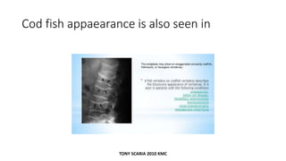 Musculoskeletal radiology revision notes | PDF