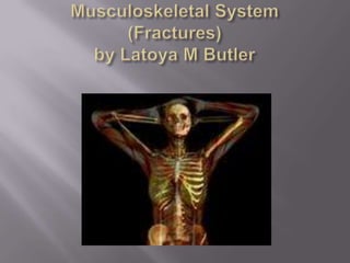 Musculoskeletal System(Fractures)by Latoya M Butler 