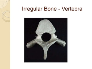 Irregular Bone - Vertebra
 