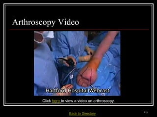 Arthroscopy Video




                       Click here to view a video on arthroscopy.

Medical Terminology: A Living Language, Fourth Edition
                                                                        115
Bonnie F. Fremgen and Suzanne S. Frucht         Back     to Directory
 