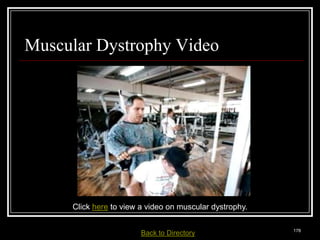 Muscular Dystrophy Video




                  Click here to view a video on muscular dystrophy.

Medical Terminology: A Living Language, Fourth Edition
                                                                        178
Bonnie F. Fremgen and Suzanne S. Frucht         Back     to Directory
 