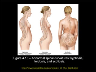 Figure 4.13 – Abnormal spinal curvatures: kyphosis,
                    lordosis, and scoliosis.

                  http://www.spinaldoc.com/Anatomy_of_the_Back.php byRiver, NewEducation, Inc.
Medical Terminology: A Living Language, Fourth Edition
                                                          Copyright ©2009
                                                              Upper Saddle
                                                                           Pearson
                                                                                   Jersey 07458
                                                                                       92
Bonnie F. Fremgen and Suzanne S. Frucht                                            All rights reserved.
 