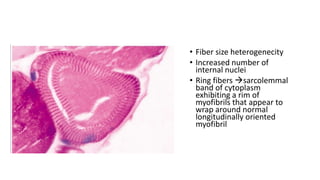 Subfibrillose Rings Musculoskeletal system revision notes | PDF