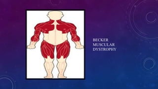 BECKER
MUSCULAR
DYSTROPHY
 
