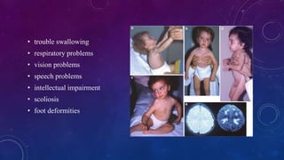 • trouble swallowing
• respiratory problems
• vision problems
• speech problems
• intellectual impairment
• scoliosis
• foot deformities
 