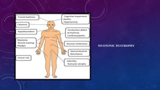 MYOTONIC DYSTROPHY
 