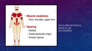 OCULOPHARYNGEAL
MUSCULAR
DYSTROPHY
 