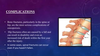 COMPLICATIONS
• Bone fractures, particularly in the spine or
hip, are the most serious complications of
osteoporosis.
• Hip fractures often are caused by a fall and
can result in disability and even an
increased risk of death within the first year
after the injury.
• In some cases, spinal fractures can occur
even if you haven't fallen.
 