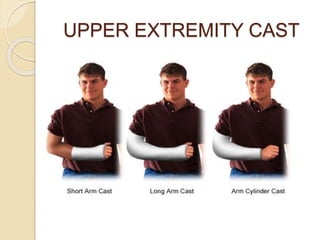 UPPER EXTREMITY CAST
 