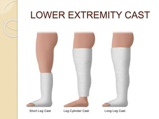 LOWER EXTREMITY CAST
 