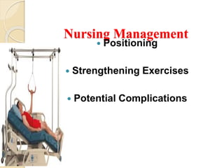 Nursing Management
 Positioning
 Strengthening Exercises
 Potential Complications
 