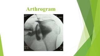 Musculoskeletal system swetha | PPTX
