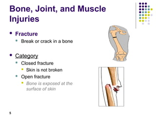Musculo skeletal trauma. Bone, Joint, and Muscle Injuries | PPT