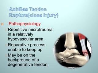 Knee high christmas socks