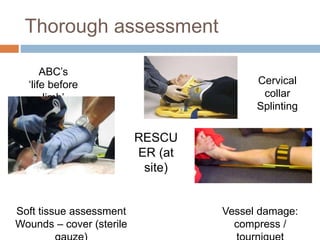 Thorough assessment
RESCU
ER (at
site)
ABC’s
‘life before
limb’
Cervical
collar
Splinting
Soft tissue assessment
Wounds – cover (sterile
Vessel damage:
compress /
 