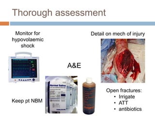 Thorough assessment
A&E
Monitor for
hypovolaemic
shock
Detail on mech of injury
Open fractures:
• Irrigate
• ATT
• antibiotics
Keep pt NBM
 