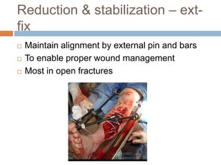 Reduction & stabilization – ext-
fix
 Maintain alignment by external pin and bars
 To enable proper wound management
 Most in open fractures
 