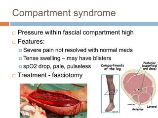 Compartment syndrome
 Pressure within fascial compartment high
 Features:
 Severe pain not resolved with normal meds
 Tense swelling – may have blisters
 spO2 drop, pale, pulseless
 Treatment - fasciotomy
 