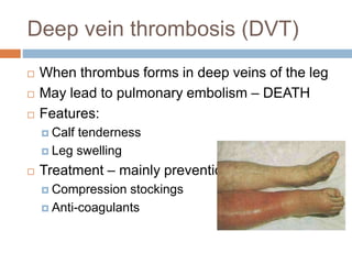 Deep vein thrombosis (DVT)
 When thrombus forms in deep veins of the leg
 May lead to pulmonary embolism – DEATH
 Features:
 Calf tenderness
 Leg swelling
 Treatment – mainly prevention
 Compression stockings
 Anti-coagulants
 