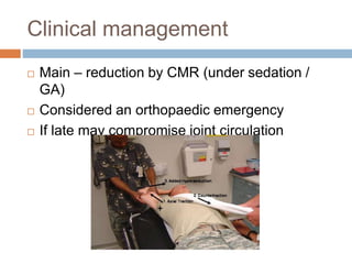 Clinical management
 Main – reduction by CMR (under sedation /
GA)
 Considered an orthopaedic emergency
 If late may compromise joint circulation
 