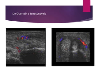 msk-ultrasound-and-guided-injections-in-private-practice-pptx