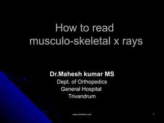 How to read
musculo-skeletal x rays

    Dr.Mahesh kumar MS
     Dept. of Orthopedics
      General Hospital
         Trivandrum


           www.similima.com   1
 