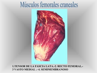 1
2
3
1.TENSOR DE LA FASCIA LATA.-2. RECTO FEMORAL.-
3 VASTO MEDIAL .- 4. SEMIMEMBRANOSO
4