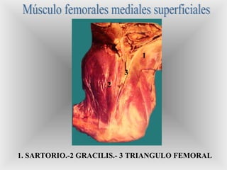 1
2
3
1. SARTORIO.-2 GRACILIS.- 3 TRIANGULO FEMORAL