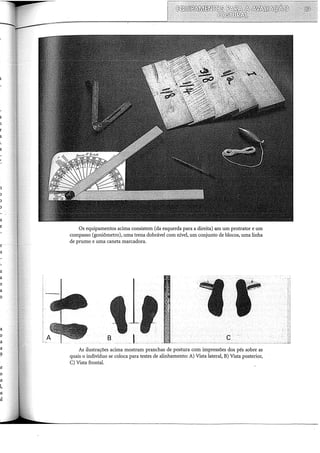 1
r
Os equipamentos acima consistem (da esquerda para a direita) em um protrator e um
compasso (goniômetro), uma trena dobrável com nível, um conjunto de blocos, uma linha
de prumo e uma caneta marcadora.
G
As ilustrações acima mostram pranchas de postura com impressões dos pés sobre as
quais o indivíduo se coloca para testes de alinhamento: A) Vista lateral, B) Vista posterior,
C) Vista frontal.
 