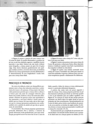 A Figura A mostra a postura de uma criança com
18 meses de idade. Os quadris flexionados e a postura em
pé com os pés bem afastados sugerem o equilíbrio incerto
associado a essa idade. Embora não seja muito evidente
nesta fotografia, a criança possui um grau leve de geno
valgo. (Esse desvio diminuiu gradativamente sem qual-
quer medida corretiva e, em torno dos 6 anos, os membros
inferiores da criança apresentaram um bonialiriliamento.)
O desenvolvimento do arco longitudinal é muito bom
para uma criança dessa idade.
PESCOÇO ETRONCO
No inicío da infância, existe um desequilíbrio per-
sistente entre a força dos músculos anteriores e poste-
riores do tronco e do pescoço. A força maior dos mús-
culos posteriores permite que a criança eleve a cabeça e
o tronco para trás antes de conseguir elevá-los para
frente sem auxílio. Embora a força dos músculos abdo-
minais e flexores do pescoço nunca seja equivalente à
dos oponentes, a sua força relativa é muito maior no
adulto que na criança. Por essa razão, não se deve espe-
rar que as crianças apresentem parâmetros em confor-
midade com o padrão do adulto até que elas se aproxi-
mem da maturidade.
É característico das crianças pequenas apresentarem
protrusão abdominal. Para a maioria, o contorno da
- parede abdominal muda gradualmente, mas uma modi-
ficação perceptível ocorre em torno dos 10 aos 12 anos de
A Figura B mostra uma criança de 7 anos cuja pos-
tura é boa para sua idade.
A Figura C mostra uma postura ruim numa criança de
6 anos. Ela apresenta a cabeça para frente, cifose, depressão
torácica e tendência à postura sway-back. A proeminência
das escápulas é evidente"na vista lateral.
A Figura D mostra uma lordose acentuada numa
ciiançade~Sanos. É-nêêessano_uill_colete para manter as
costas bem alinhadas esuportar o abdome junto com exer-
cícios terapêuticos quando o alinhamento for defeituoso.
idade, quando a linha da cintura se torna relativamente
menor e a protrusão abdominal desaparece.
A postura das costas varia um pouco segundo a
idade da criança. Uma criança pequena pode ficar em pé
discretamente inclinada para frente no nível dos quadris
e com os pés afastados para um melhor equilíbrio (ver
Figura A). As crianças no início da fase escolar parecem
apresentar um desvio típico da região dorsal no qual as
escápulas são bem proeminentes. Aproximadamente aos
9 anos de idade, parece iniciar uma tendência de aumen-
to da curva anterior ou lordose da região lombar. Os des-
vios devem se tornar menos pronunciados à medida que
a criança for crescendo (19, 22).
Foi demonstrado que a amplitude de movimento nor-
mal da flexão e da extensão lombar diminui com o aumen-
to da idade tanto em crianças quanto em adultos (23-25).
 