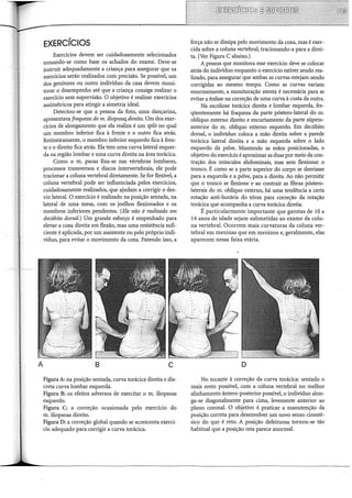 A
EXERCÍCIOS
Exercícios devem ser cuidadosamente selecionados
tomando-se como base os achados do exame. Deve-se
instruir adequadamente a criança para assegurar que os
exercícios serão realizados com precisão. Se possível, um
dos genitores ou outro indivíduo da casa devem moni-
torar o desempenho até que a criança consiga realizar o
exercício sem supervisão. O objetivo é realizar exercícios
assimétricos para atingir a simetria ideal.
Detectou-se que a pessoa da foto, uma dançarina,
apresentava fraqueza do m. iliopsoa:j direito. Um dos exer-
cícios de alongamento que ela realiza é um split no qual
um membro inferior fica à frente e o outro fica atrás.
Rotineiramente, o membro inferior esquerdo fica à fren-
te e o direito fica atrás. Ela tem uma curva lateral esquer-
da na região lombar e uma curva direita na área torácica.
Como o m. psoas fixa-se nas vértebras lombares,
processos transversos e discos intervertebrais, ele pode
tracionar a coluna vertebral diretamente. Se for flexível, a
coluna vertebral pode ser influenciada pelos exercícios,
cuidadosamente realizados, que ajudam a corrigir o des-
vio lateral. O exercício é realizado na posição sentada, na
lateral de uma mesa, com os joelhos flexionados e os
membros inferiores pendentes. (Ele não é realizado em
decúbito dorsal.) Um grande esforço é empenhado para
elevar a coxa direita em flexão, mas uma resistência sufi-
ciente é aplicada, por um assistente ou pelo próprio indi-
víduo, para evitar o movimento da coxa. Fazendo isso, a
B c
Figura A: na posição sentada, curva torácica direita e dis-
creta curva lombar esquerda.
Figura B: os efeitos adversos de exercitar o m. iliopsoas
esquerdo.
Figura C: a correção ocasionada pelo exercício do
m. iliopsoas direito.
Figura D: a correção global quando se acrescenta exercí-
cio adequado para corrigir a curva torácica.
força não se dissipa pelo movimento da coxa, mas é exer-
cida sobre a coluna vertebral, tracionando-a para a direi-
ta. (Ver Figura C abaixo.)
A pessoa que monitora esse exercício deve se colocar
atrás do indivíduo enquanto o exercício estiver sendo rea-
lizado, para assegurar que ambas as curvas estejam sendo
corrigidas ao mesmo tempo. Como as curvas variam
enormemente, a monitoração atenta é necessária para se
evitar a ênfase na correção de uma curva à custa da outra.
Na escoliose torácica direita e lombar esquerda, fre-
qüentemente há fraqueza da parte póstero-lateral do m.
oblíquo externo direito e encurtamento da parte súpero-
anterior do m. oblíquo externo esquerdo. Em decúbito
dorsal, o indivíduo coloca a mão direita sobre a parede
torácica lateral direita e a mão esquerda sobre o lado
esquerdo da pelve. Mantendo as mãos posicionadas, o
objetivo do exercício é aproximar as duas por meio da con-
tração dos músculos abdominais, mas sem flexionar o
tronco. É como se a parte superior do corpo se desviasse
para a esquerda e a pelve, para a direita. Ao não permitir
que o tronco se flexione e ao contrair as fibras póstero-
laterais do m. oblíquo externo, há uma tendência a certa
rotação anti-horária do tórax para correção da rotação
torácica que acompanha a curva torácica direita.
É particularmente importante que garotas de 10 a
14 anos de idade sejam submetidas ao exame da colu-
na vertebral. Ocorrem mais curvaturas da coluna ver-
tebral em meninas que em meninos e, geralmente, elas
aparecem nessa faixa etária.
D
No tocante à correção da curva torácica: sentado o
mais ereto possível, com a coluna vertebral no melhor
alinhamento ântero-posterior possível, o indivíduo alon-
ga-se diagonalmente para cima, levemente anterior ao
plano coronal. O objetivo é praticar a manutenção da
posição correta para desenvolver um novo senso cinesté-
sico do que é reto. A posição defeituosa tornou-se tão
habitual que a posição reta parece anormal.
 