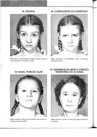 M. FRONTAL
Teste: elevar as sobrancelhas e enrugar a fronte, como em
uma expressão de surpresa ou medo.
M. NASAL, PORÇÃO ALAR
Teste: aumentar a abertura das narinas, como numa res-
piração forçada ou difícil.
M. CORRUGADOR DO SUPERCÍLIO
Teste: aproximar as sobrancelhas, como se estivesse
franzindo a fronte.
M. DEPRESSOR DO SEPTO EPORÇÃO
TRANSVERSA DO M. NASAL
Teste: tracionar a ponta do nariz para baixo, estreitando
as narinas.
 