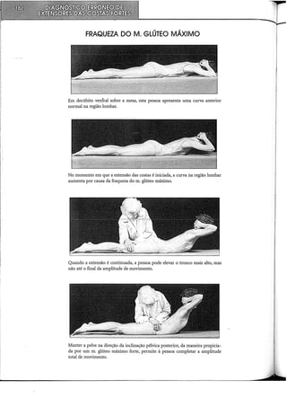 FRAQUEZA DO M. GLÚTEO MÁXIMO
Em decúbito ventral sobre a mesa, esta pessoa apresenta uma curva anterior
normal na região lombar.
No momento em que a extensão das costas é iniciada, a curva na região lombar
aumenta por causa da fraqueza do m. glúteo máximo.
Quando a extensão é continuada, a pessoa pode elevar o tronco mais alto, mas
não até o final da amplitude de movimento.
Manter a pelve na direção da inclinação pélvica posterior, da maneira propicia-
da por um m. glúteo máximo forte, permite à pessoa completar a amplitude
total de movimento.
 