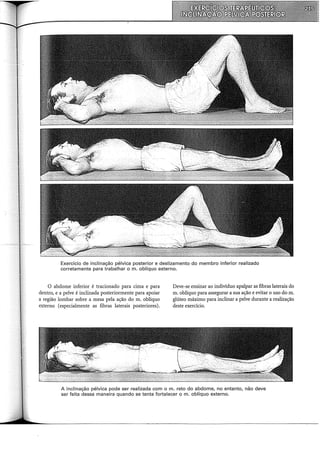 Exercício de inclinação pélvica posterior e deslizamento do membro inferior realizado
corretamente para trabalhar o m. oblíquo externo.
O abdome inferior é tracionado para cima e para
dentro, e a pelve é inclinada posteriormente para apoiar
a região lombar sobre a mesa pela ação do m. oblíquo
externo (especialmente as fibras laterais posteriores).
Deve-se ensinar ao indivíduo apalpar as fibras laterais do
m. oblíquo para assegurar a sua ação e evitar o uso do m.
glúteo máximo para inclinar a pelve durante a realização
deste exercício.
A inclinação pélvica pode ser realizada com o m. reto do abdome, no entanto, não deve
ser feita dessa maneira quando se tenta fortalecer o m. oblíquo externo.
 