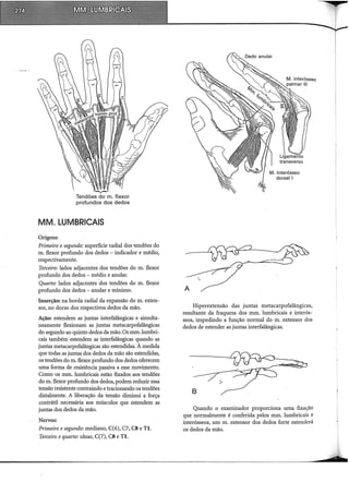 Tendões do m. flexor
profundos dos dedos
MM. LUMBRICAIS
Origens:
Primeiro e segundo: superfície radial dos tendões do
m. flexor profundo dos dedos - indicador e médio,
respectivamente.
Terceiro: lados adjacentes dos tendões do m. flexor
profundo dos dedos - médio e anular.
Quarto: lados adjacentes dos tendões do m. flexor
profundo dos dedos - anular e mínimo.
Inserção: na borda radial da expansão dom. exten-
sor, no dorso dos respectivos dedos da mão.
Ação: estendem as juntas interfalângicas e simulta-
neamente flexionam as juntas metacarpofalângicas
do segundo ao quinto dedos da mão. Os mm.lumbri-
cais também estendem as interfalângicas quando as
juntas metacarpofalângicas são estendidas. À medida
que todas as juntas dos dedos da mão são estendidas,
os tendões do m. flexor profundo dos dedos oferecem
uma forma de resistência passiva a esse movimento.
Como os mm. lumbricais estão fixados aos tendões
do m. flexor profundo dos dedos, podem reduzir essa
tensão resistente contraindo etracionando os tendões
distalmente. A liberação da tensão diminui a força
contrátil necessária aos músculos que estendem as
juntas dos dedos da mão.
Nervos:
Primeiro e segundo: mediano, C(6), C7, CS e TI.
Terceiro e quarto: ulnar, C(7), CS e TI.
A
Hiperextensão das juntas metacarpofalângicas,
resultante da fraqueza dos mm. lumbricais e interós-
seos, impedindo a função normal do m. extensor dos
dedos de estender as juntas interfalângicas.
B
Quando o examinador proporciona uma fixação
que normalmente é conferida pelos mm. lumbricais e
interósseos, um m. extensor dos dedos forte estenderá
os dedos da mão.
 
