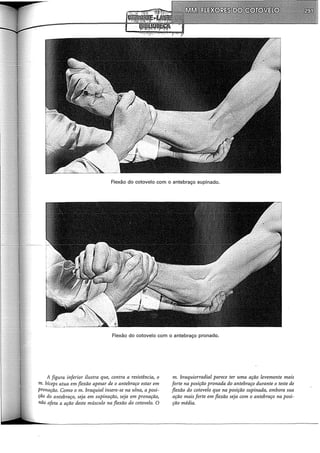 Flexão do cotovelo com o antebraço supinado.
Flexão do cotovelo com o antebraço pronado.
A figura inferior ilustra que, contra a resistência, o
m. bíceps atua em flexão apesar de o antebraço estar em
pronação. Como o m. braquial insere-se na ulna, a posi-
ção do antebraço, seja em supinação, seja em pronação,
não afeta a ação deste músculo na flexão do cotovelo. O
m. braquiorradial parece ter uma ação levemente mais
forte na posição pronada do antebraço durante o teste de
flexão do cotovelo que na posição supinada, embora sua
ação mais forte em flexão seja com o antebraço na posi-
ção média.
 