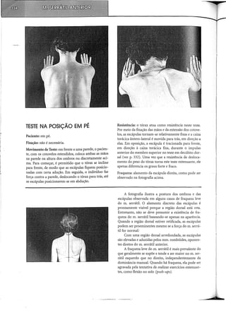 ..
!
I
..
TESTE NA POSIÇÃO EM PÉ
Paciente: em pé.
Fixação: não é necessária.
Movimento de Teste: em frente a uma parede, o pacien-
te, com os cotovelos estendidos, coloca ambas as mãos
na parede na altura dos ombros ou discretamente aci-
ma. Para começar, é permitido que o tórax se incline
para frente, de modo que as escápulas fiquem posicio-
nadas com certa adução. Em seguida, o indivíduo faz
força contra a parede, deslocando o tórax para trás, até
as escápulas posicionarem-se em abdução.
Resistência: o tórax atua como resistência neste teste.
Por meio da fixação das mãos e da extensão dos cotove-
los, as escápulas tornam-se relativamente fixas e a caixa
torácica ântero-lateral é movida para trás, em direção a
elas. Em oposição, a escápula é tracionada para frente,
em direção à caixa torácica fixa, durante o impulso
anterior do membro superior no teste em decúbito dor-
sal (ver p. 332). Uma vez que a resistência de desloca-
mento do peso do tórax torna este teste e:x.'tenuante, ele
apenas diferencia os graus forte e fraco.
Fraqueza: alamento da escápula direita, como pode ser
observado na fotografia acima.
A fotografia ilustra a postura dos ombros e das
escápulas observada em alguns casos de fraqueza leve
do m. serrátil. O alamento discreto das escápulas é
prontamente visível porque a região dorsal está reta.
Entretanto, não se deve presumir a existência de fra-
queza do m. serrátil baseando-se apenas na aparência.
Quando a região dorsal estiver retificada, as escápulas
podem ser proeminentes mesmo se a força dom. serrá-
til for normal:
Com uma região dorsal arredondada, as escápulas
são elevadas e aduzidas pelos mm. rombóides, oponen-
tes diretos do m. serrátil anterior.
A fraqueza leve do m. serrátil é mais prevalente do
que geralmente se supõe e tende a ser maior no m. ser-
rátil esquerdo que no direito, independentemente da
dominância manual. Quando há fraqueza, ela pode ser
agravada pela tentativa de realizar exercícios extenuan-
tes, como flexão no solo (push-ups).
I
À
 