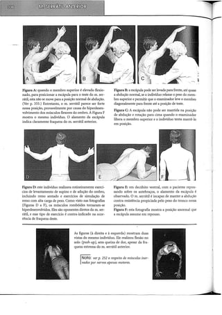 Figura A: quando o membro superior é elevado flexio-
nado, para posicionar a escápula para o teste do m. ser-
rátil, esta não se move para a posição normal de abdução.
(Ver p. 333.) Entretanto, o m. serrátil parece ser forte
nessa posição, provavelmente por causa do hiperdesen-
volvimento dos músculos flexores do ombro. A Figura F
mostra o mesmo indivíduo. O alamento da escápula
indica claramente fraqueza do m. serrátil anterior.
Figura D: este indivíduo realizava rotineiramente exercí-
cios de levantamento de supino e de adução do ombro,
incluindo remo sentado e exercícios de simulação de
remo com alta carga de peso. Como visto nas fotografias
(Figuras D a F), os músculos rombóides tornaram-se
hiperdesenvolvidos. Eles são oponentes diretos dom. ser-
rátil, e esse tipo de exercício é contra-indicado na ocor-
rência de fraqueza deste.
Figura B: a escápula pode ser levada para frente, até quase
a abdução normal, se o indivíduo relaxar o peso do mem-
bro superior e permitir que o examinador leve o membro
diagonalmente para frente até a posição de teste.
Figura C: A escápula não pode ser mantida na posição
de abdução e rotação para cima quando o examinador
libera o membro superior e o individuo tenta mantê-lo
em posição.
Figura E: em decúbito ventral, com o paciente repou-
sando sobre os antebraços, o alamento da escápula é
observado. O m. serrátil é incapaz de manter a abdução
contra resistência propiciada pelo peso do tronco nessa
posição.
Figura F: esta fotografia mostra a posição anormal que
a escápula assume em repouso.
As figuras (à direita e à esquerda) mostram duas
vistas do mesmo indivíduo. Ele realizou flexão no
solo (push-up), sem queixa de dor, apesar da fra-
queza extrema do m. serrátil anterior.
Nota: ver p. 252 a respeito de músculos iner-
vados por nervos apenas motores.
 