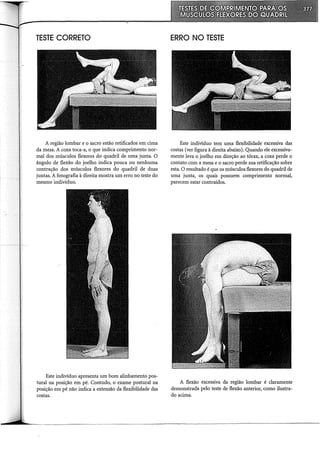 TESTE CORRETO
A região lombar e o sacro estão retificados em cima
da mesa. A coxa toca-a, o que indica comprimento nor-
mal dos músculos flexores do quadril de uma junta. O
ângulo de flexão do joelho indica pouca ou nenhuma
contração dos músculos flexores do quadril de duas
juntas. A fotografia à direita mostra um erro no teste do
mesmo indivíduo.
Este indivíduo apresenta um bom alinhamento pos-
tural na posição em pé. Contudo, o exame postural na
posição em pé não indica a extensão da flexibilidade das
costas.
ERRO NO TESTE
Este indivíduo tem uma flexibilidade excessiva das
costas (ver figura à direita abaixo). Quando ele excessiva-
mente leva o joelho em direção ao tórax, a coxa perde o
contato com a mesa e o sacro perde sua retificação sobre
esta. O resultado é que os músculos flexores do quadril de
uma junta, os quais possuem comprimento normal,
parecem estar contraídos.
A flexão excessiva da região lombar é claramente
demonstrada pelo teste de flexão anterior, como ilustra-
do acima.
 