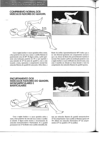 COMPRIMENTO NORMAL DOS
MÚSCULOS FLEXORES DO QUADRIL
Com a região lombar e o sacro apoiados sobre a mesa,
a face posterior da coxa toca a mesa e o joelho flexiona-se
passivamente cerca de 80°. Na figura acima, a pelve apre-
senta uma inclinação posterior de 10°, o que equivale a
uma extensão de 10° da junta do quadril e, com a coxa
tocando a mesa, representa o comprimento normal dos
músculos flexores do quadril de uma junta. Além disso, a
Com a região lombar e o sacro apoiados sobre a
mesa, a face posterior da coxa não toca a mesa e o joelho
se estende. A figura acima mostra o encurtamento de
músculos monoarticulares e biarticulares. Se o quadril
permanecer em 15° de flexão com o joelho estendido, fal-
flexão do joelho (aproximadamente 80°) indica que o
m. reto femoral apresenta um comprimento normal e
que o m. tensor da fáscia lata provavelmente também é
normal. Para manter a pelve em inclinação posterior com
a região lombar e o sacro retificado em cima da mesa, uma
coxa é mantida em direção ao tórax durante o teste do
comprimento dos músculos flexores do quadril opostos.
tam aos músculos flexores do quadril monoarticulares
15° de comprimento. Caso o joelho se flexione apenas até
70°, faltam aos músculos biarticulares 25° de compri-
mento (.J.SO no quadril e 10° no joelho).
 