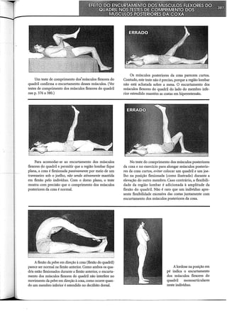 Um teste de comprimento dos'músculos flexores do
quadril confirma o encurtamento desses músculos. (Ver
testes de comprimento dos músculos flexores do quadril
nas p. 376 a 380.)
Para acomodar-se ao encurtamento dos músculos
flexores do quadril e permitir que a região lombar fique
plana, a coxa é flexionada passivamente por meio de um
travesseiro sob o joelho, não sendo ativamente mantida
em flexão pelo indivíduo. Com o dorso plano, o teste
mostra com precisão que o comprimento dos músculos
posteriores da coxa é normal.
A flexão da pelve em direção à coxa (flexão do quadril)
parece ser normal na flexão anterior. Como ambos os qua-
dris estão flexionados durante a flexão anterior, o encurta-
mento dos músculos flexores do quadril não interfere no
movimento da pelve em direção à coxa, como ocorre quan-
do um membro inferior é estendido no decúbito dorsal.
Os músculos posteriores da coxa parecem curtos.
Contudo, este teste não é preciso, porque a região lombar
não está achatada sobre a mesa. O encurtamento dos
músculos flexores do quadril do lado do membro infe-
rior estendido mantém as costas em hiperextensão.
No teste do comprimento dos músculos posteriores
da coxa e no exercício para alongar músculos posterio-
res da coxa curtos, evitar colocar um quadril e um joe-
lho na posição flexionada (como ilustrado) durante a
elevação do outro membro. Caso contrário, a flexibili-
dade da região lombar é adicionada à amplitude da
flexão do quadril. Não é raro que um indivíduo apre-
sente flexibilidade excessiva das costas juntamente com
encurtamento dos músculos posteriores da coxa.
Alordose na posição em
pé indica o encurtamento
dos músculos flexores do
quadril monoarticulares
neste indivíduo.
 
