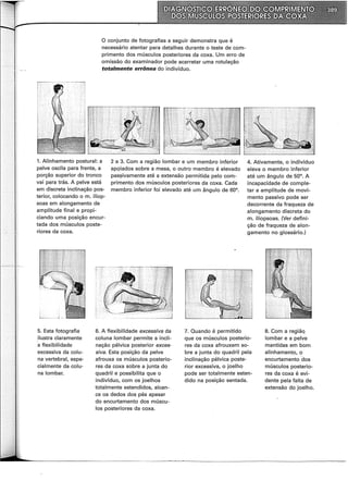O conjunto de fotografias a seguir demonstra que é
necessário atentar para detalhes durante o teste de com-
primento dos músculos posteriores da coxa. Um erro de
omissão do examinador pode acarretar uma rotulação
totalmente errônea do indivíduo.
1. Alinhamento postura!: a
pelve oscila para frente, a
porção superior do tronco
vai para trás. A pelve está
em discreta inclinação pos-
terior, colocando o m. iliop-
soas em alongamento de
amplitude final e propi-
ciando uma posição encur-
tada dos músculos poste-
riores da coxa.
2 e 3. Com a região lombar e um membro inferior
apQiados sobre a mesa, o outro membro é elevado
pas~ivamente até a extensão permitiçla pelo com-
primento dos músculos posteriores çla coxa. Cada
membro inferior foi elevado até um ~ngulo de 60°.
7. Quando é permitido
4. Ativamente, o indivíduo
eleva o membro inferior
até um ângulo de 50°. A
incapacidade de comple-
tar a amplitude de movi-
mento passivo pode ser
decorrente da fraqueza de
alongamento discreta do
m. iliopsoas. (Ver defini-
ção de fraqueza de alon-
gamento no glossário.)
5. Esta fotografia
ilustra claramente
a flexibilidade
excessiva da colu-
na vertebral, espe-
cialmente da colu-
na lombar.
6. A flexibilidade excessiva da
coluna lombar permite a incli-
nação pélvica posterior exces-
siva. Esta posição da pelve
afrouxa os músculos posterio-
res da coxa sobre a junta do
quadril e possibilita que o
indivíduo, com os joelhos
totalmente estendidos, alcan-
ce os dedos dos pés apesar
do encurtamento dos múscu-
los posteriores da coxa.
que os músculos posterio-
res da coxa afrouxem so-
bre a junta do quadril pela
inclinação pélvica poste-
rior excessiva, o joelho
pode ser totalmente esten-
dido na posição sentada.
8. Com a regiãq
lombar e a pelve
mantidas em bom
alinhamento, o
encurtamento dos
músculos posterio-
res da coxa é evi-
dente pela falta de
extensão do joelho.
---------------------------~-~-----------------------
 