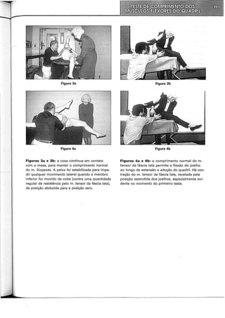 Figura 3a
Figura 4a
Figuras 3a e 3b: a coxa continua em contato
com a mt;lsa, para manter o comprimento normal
do m. iliopsoas. A pelve foi estabilizada para impe-
dir qualquer movimento lateral quando o membro
inferior for movido de volta (contra uma quantidade
regular de resistência pelo m. tensor da fáscia lata),
da posição abduzida para a posição zero.
Figura 3b
Figura 4b
Figuras 4a e 4b: ·O comprimento normal do m.
tensor da fáscia lata permite a flexão do joelho
ao longo da extensão e adução do quadril. Há con-
tração do m. tensor da fáscia lata, revelada pela
posição estendida dos joelhos, especialmente evi-
dente no momento do primeiro teste.
 