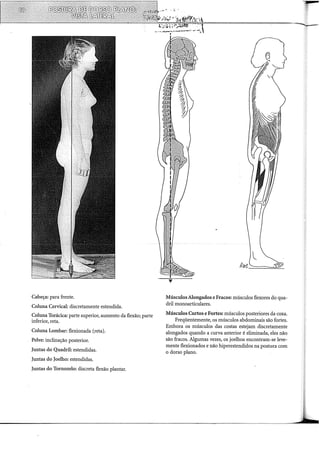 Cabeça: para frente.
Coluna Cervical: discretamente estendida.
Coluna Torácica: parte superior, aumento da flexão; parte
inferior, reta.
Coluna Lombar: flexionada (reta).
Pelve: inclinação posterior.
Juntas do Quadril: estendidas.
Juntas do Joelho: estendidas.
Juntas do Tornozelo: discreta flexão plantar.
l=============--~-
Músculos Alongados e Fracos: músculos flexores do qua-
dril monoarticulares.
Músculos Curtos e Fortes: músculos posteriores da coxa.
Freqüentemente, os músculos abdominais são fortes.
Embora os músculos das costas estejam discretamente
alongados quando a curva anterior é eliminada, eles não
são fracos. Algumas vezes, os joelhos encontram-se leve-
mente flexionados e não hiperestendidos na postura com
o dorso plano.
 