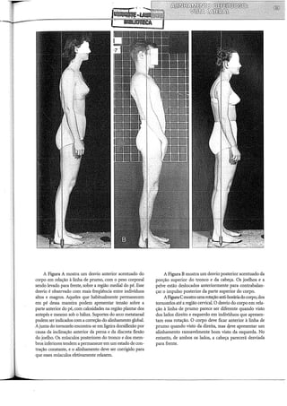 A Figura A mostra um desvio anterior acentuado do
corpo em relação à linha de prumo, com o peso corporal
sendo levado para frente, sobre a região mediai do pé. Esse
desvio é observado com mais freqüência entre indivíduos
altos e magros. Aqueles que habitualmente permanecem
em pé dessa maneira podem apresentar tensão sobre a
parte anterior do pé, com calosidades na região plantar dos
antepés e mesmo sob o hálux. Suportes do arco metatarsal
podem ser indicados com a correção do alinhamento global.
Ajunta do tornozelo encontra-se em ligeira dorsiflexão por
causa da inclinação anterior da perna e da discreta flexão
do joelho. Os músculos posteriores do tronco e dos mem-
bros inferiores tendem a permanecer em um estado de con-
tração constante, e o alinhamento deve ser corrigido para
que esses músculos efetivamente relaxem.
A Figura B mostra um desvio posterior acentuado da
porção superior do tronco e da cabeça. Os joelhos e a
pelve estão deslocados anteriormente para contrabalan-
çar o impulso posterior da parte superior do corpo.
AFiguraCmostraumarotação anti-horáriado corpo, dos
tornozelos até a região cervical. O desvio do corpo em rela-
ção à linha de prumo parece ser diferente quando visto
dos lados direito e esquerdo em indivíduos que apresen-
tam essa rotação. O corpo deve ficar anterior à linha de
prumo quando visto da direita, mas d.eve apresentar um
alinhamento razoavelmente bom visto da esquerda. No
entanto, de ambos os lados, a cabeça parecerá desviada
para frente.
 